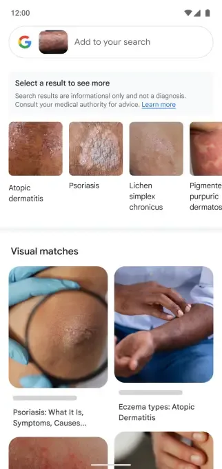 Google Lens dəri