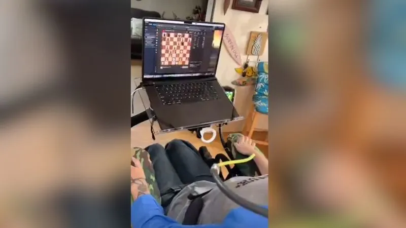 Neuralink xəstə şahmat