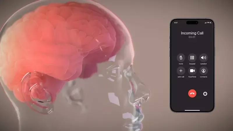 Neuralink beyin